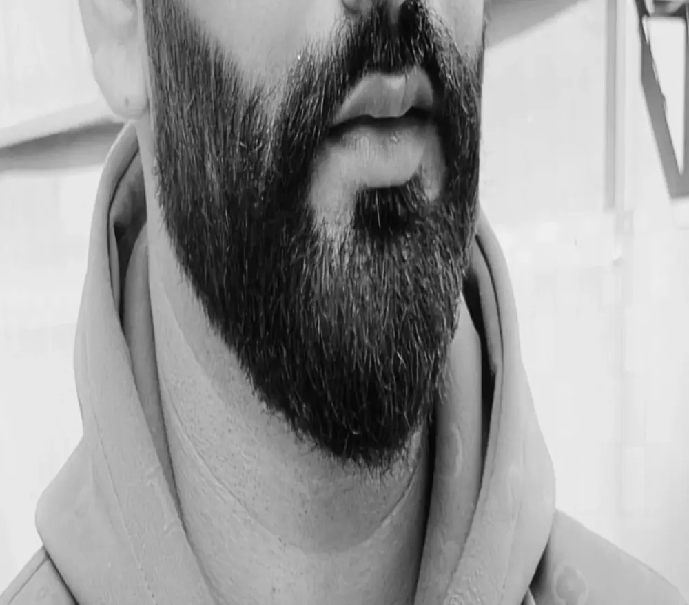 BeardKingoBack