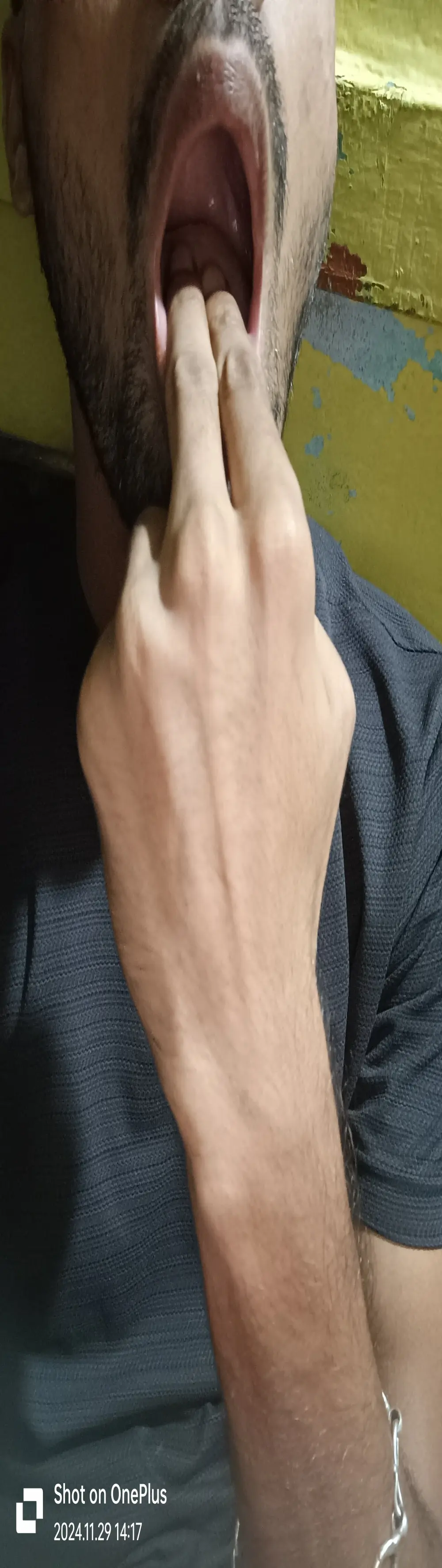 __skinny_Bigass__26