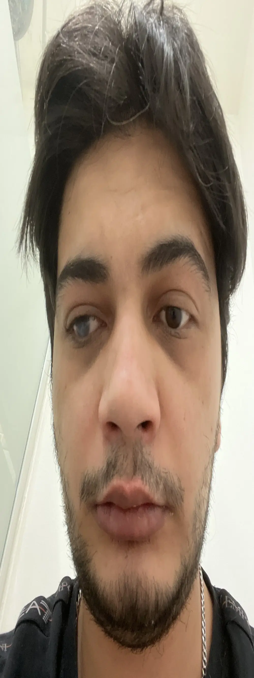 grbite385